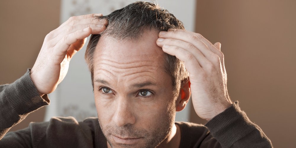 can rogaine regrow frontal hair